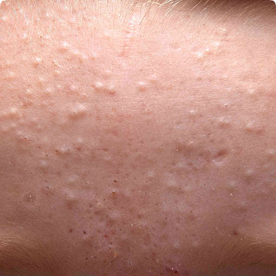 Block Image
