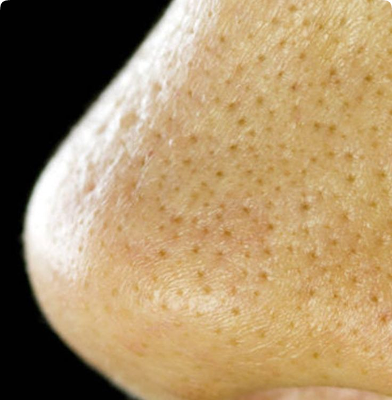 Block Image
